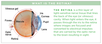 What Is a Detached Retina? - Outlook Eyecare